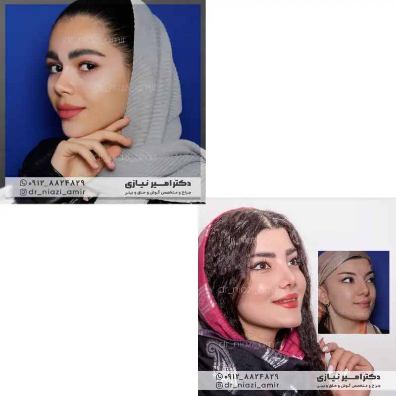 جراحی بینی ترمیمی