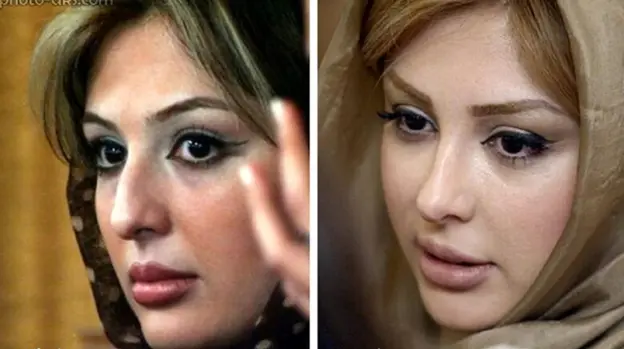 جراحی بینی بازیگران ایرانی