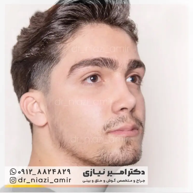 عمل بینی نیمه فانتزی آقایان