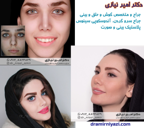 عمل زیبایی بینی