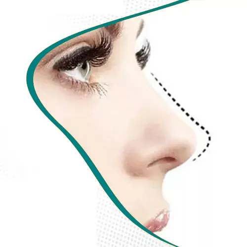 اصلی ترین تفاوت جراحی بینی فانتزی و عروسکی