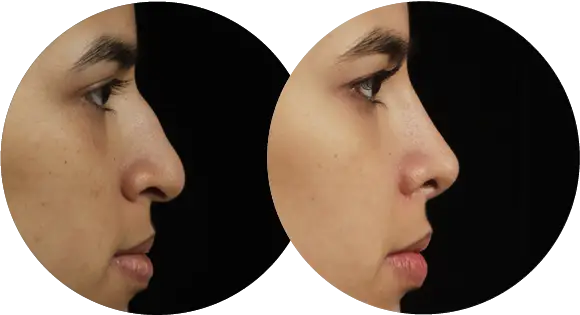 بهترین دکتر عل بینی طبیعی