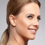 جراحی بینی طبیعی زنانه