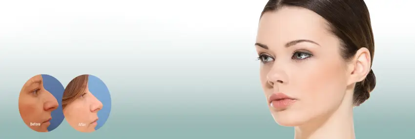 عوامل موثر بر هزینه عمل ترمیمی بینی