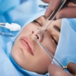 قیمت عمل ترمیمی بینی
