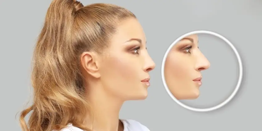 هزینه عمل ترمیمی بینی