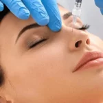 کاهش تورم بعد از عمل بینی