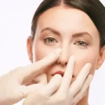 ماساژ بعد عمل بینی