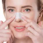 قرمزی چشم بعد از عمل بینی