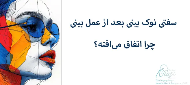 سفتی نوک بینی بعد از عمل